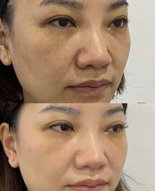 ネイル aliaハーブ水光店 エステティシャン募集のエステ・リラクイメージ