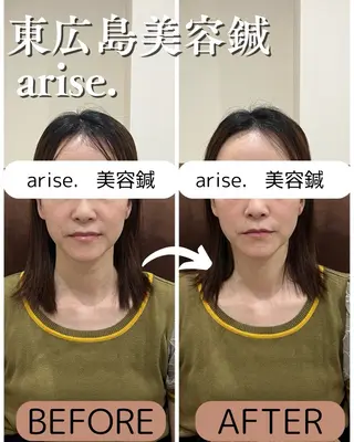 arise.所属・東広島美容鍼 /arise.のその他イメージ
