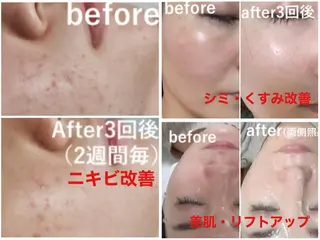 韓国美容×肌管理 kanunu鶴橋店のエステ・リラクイメージ