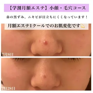 Bellesthe (ベルエステ)のエステ・リラクイメージ