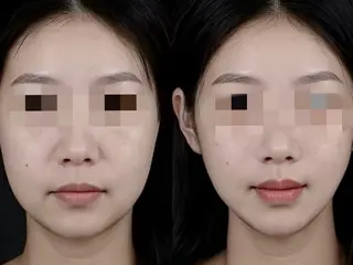 aliaハイフ&水光ジェットサロン所属・aliaハーブ水光店 エステティシャン募集のエステ・リラクイメージ