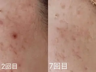 Wehana所属・Wehana salonのエステ・リラクイメージ