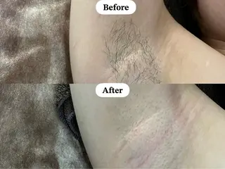 美肌脱毛/肌質改善 《ulula~梟》のエステ・リラクイメージ