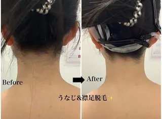 韓国肌管理×毛穴 改善専門🤍nanaのエステ・リラクイメージ