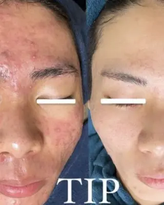 Ellebeauty relaxationのエステ・リラクイメージ