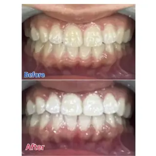 M渋谷 ホワイトニングのエステ・リラクイメージ