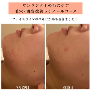 Bellesthe (ベルエステ)のエステ・リラクイメージ