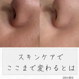 ニキビ経験者が施術 する専門サロン🌻のエステ・リラクイメージ