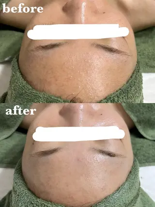 メンズ 肌質改善＆脱毛 【M Mondo】のエステ・リラクイメージ