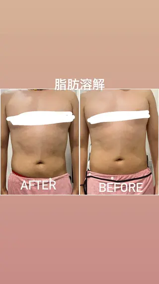 毛穴洗浄・痩身・脱毛 /アルカンジュのエステ・リラクイメージ