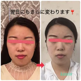小顔矯正サロン顔凛 KANAのエステ・リラクイメージ