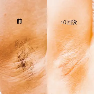 トウ フェンのエステ・リラクイメージ