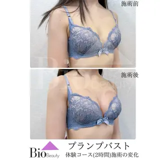 Bio Beauty 神戸本店所属・エステ豊胸マイスター 中前のエステ・リラクイメージ