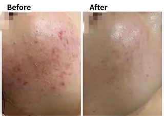 美肌脱毛サロン muroのエステ・リラクイメージ