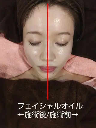 ソリーシェ鍼灸院 立野のエステ・リラクイメージ