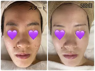 COCO beautyサロンのエステ・リラクイメージ