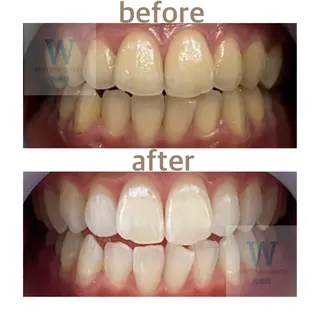 ホワイトニング ショップ船橋２号店のエステ・リラクイメージ