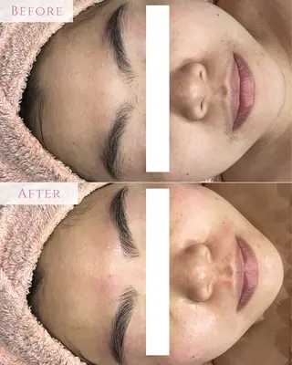 肌質改善専門サロン Bellmi/心斎橋のエステ・リラクイメージ