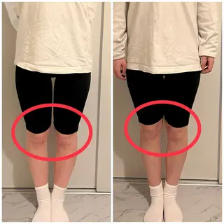 ✨ハリグリッター 山本由季✨のエステ・リラクイメージ