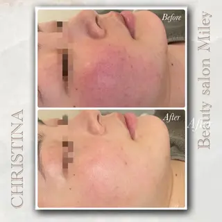 Miley/肌質改善 Megumiのエステ・リラクイメージ