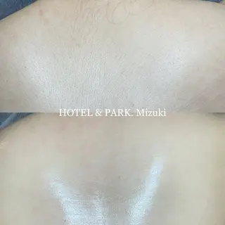HOTEL&PARK . ワックス脱毛のエステ・リラクイメージ