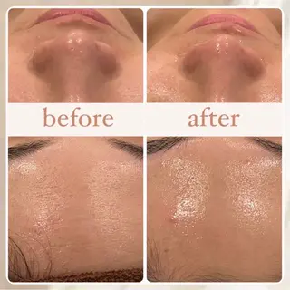 立体小顔×艶肌×美ボ ディ似合わせ施術 岡のエステ・リラクイメージ