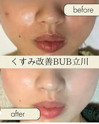 【BUB立川】 ゆかのエステ・リラクイメージ