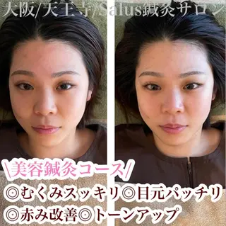 Salus鍼灸サロン 浅田のエステ・リラクイメージ