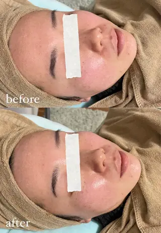 エステサロン Mi-mi.iのエステ・リラクイメージ