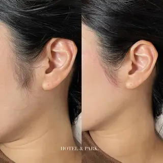 HOTEL&PARK . ワックス脱毛のエステ・リラクイメージ