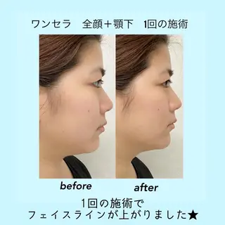 B againのエステ・リラクイメージ