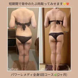 《本気痩せ×疲労改善 》  BILOOPのエステ・リラクイメージ