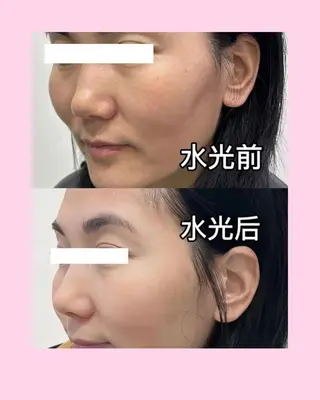 マツエク・マツパ 愛維美水光美肌専門店 メンズレディースokのエステ・リラクイメージ