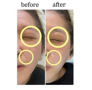 ROR Akariのエステ・リラクイメージ