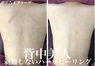 LILIANA所属・LILIANA ☆YURIのエステ・リラクイメージ