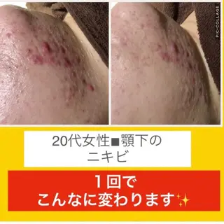 ミディアム カラー パーマ ヘアアレンジ メンズ キッズ ネイル マツエク・マツパ ニキビ・肌質改善専門 ♡人生が変わるサロンのエステ・リラクイメージ