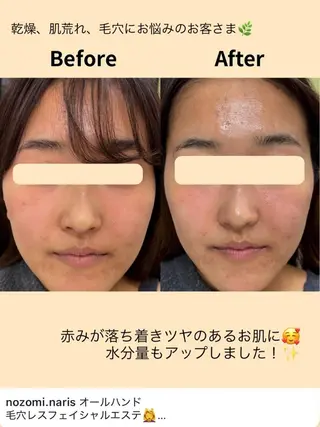 Novelle所属・nozomi.m🌷 narisのエステ・リラクイメージ