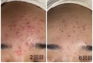 COCO beautyサロンのエステ・リラクイメージ