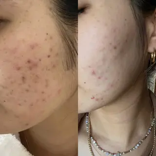 メンズ ネイル マツエク・マツパ アイブロウ dazzle M🫧のマツエク・マツパデザイン
