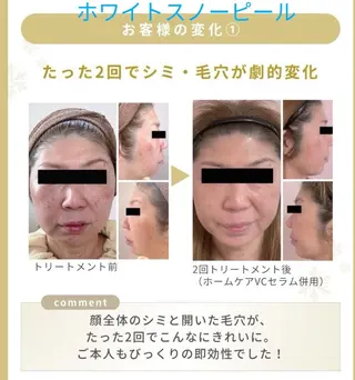 レインボーテ　座間 温活✕肌管理サロンのエステ・リラクイメージ