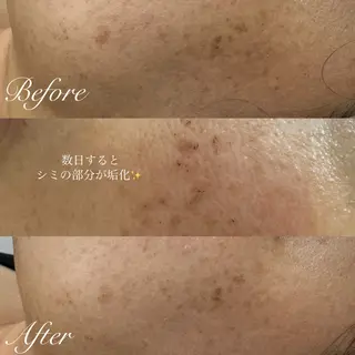 シミ🩷ニキビ専門店 Matteo🎀✨のエステ・リラクイメージ