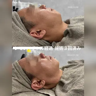 心斎橋🤍堀江.小顔 ハーブ.痩身クレビアのエステ・リラクイメージ