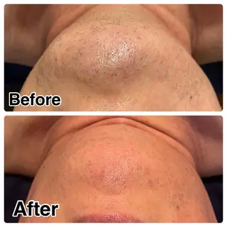 🌴Beauty Salon LANAのエステ・リラクイメージ