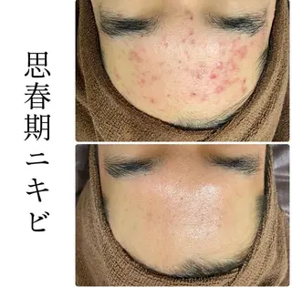 ハーブピーリング専門 BIOPLUS+川崎のエステ・リラクイメージ