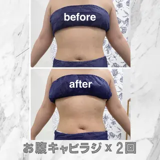 小顔痩身HALO 二宮早織のエステ・リラクイメージ