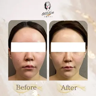 💎allilin 五所川原💎本間のエステ・リラクイメージ