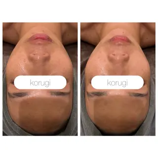 小顔コルギ ☆表参道/外苑前のエステ・リラクイメージ