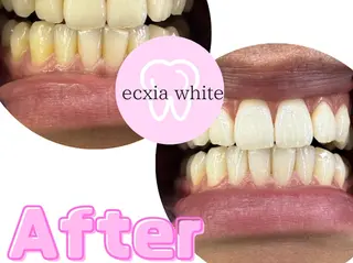 セルフホワイトニング エクシア浜松店のその他イメージ