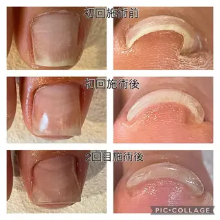 gorella Ａのネイルデザイン