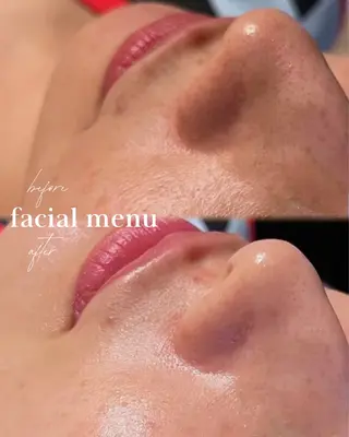 Linoa skin salon所属・Linoa 大名のエステ・リラクイメージ